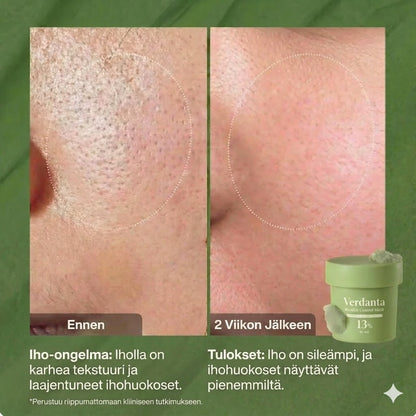 Verdanta| Holy Brasil Diepe Masker reinigt je poriën