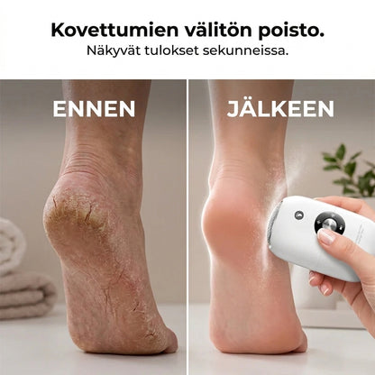 Kannettava sähköinen jalkaraspi