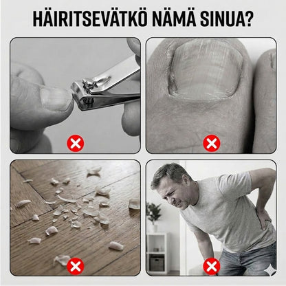 ✂️ Roiskesuojattu kynsisakset ruostumattomasta teräksestä – laaja aukko ja turvallinen säilytys!
